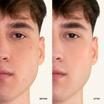 NOISS Purifying Oxygen Foam Cleanser before and after results