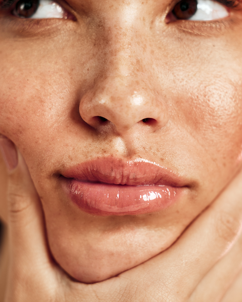 NOISS blog: Pimple, φακίδες, tan lines - τι λέει το δέρμα σου