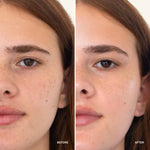 NOISS Brightening Jelly Day Cream before and after results
