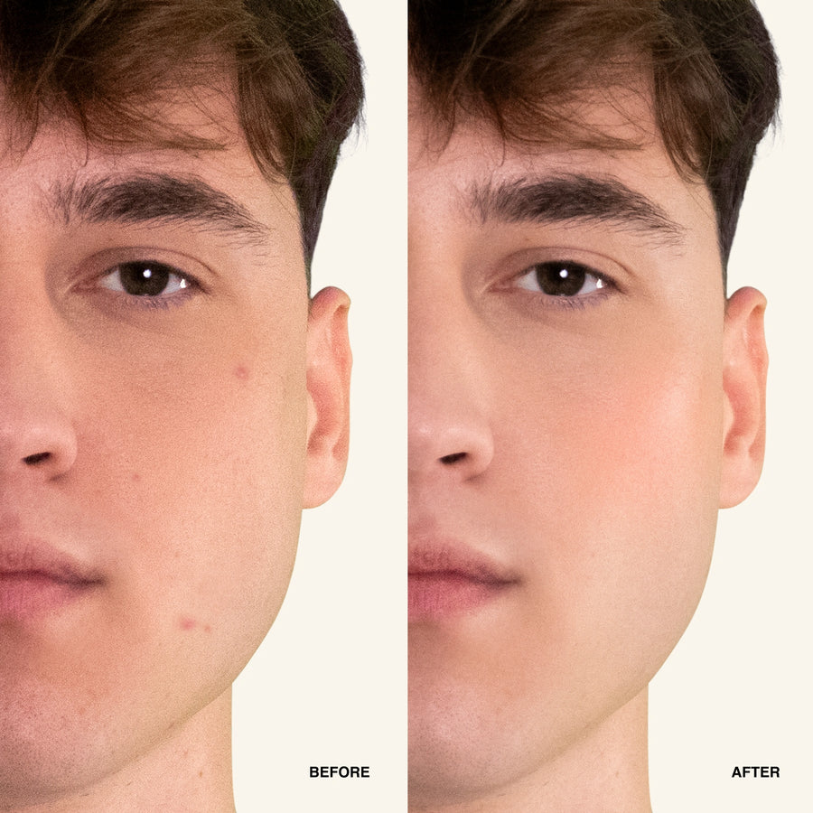 NOISS Purifying Oxygen Foam Cleanser before and after results